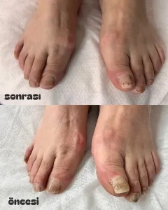 Çankaya Pedikür Ayak ve Tırnak Bakım Merkezi