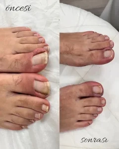 Çankaya Pedikür Ayak ve Tırnak Bakım Merkezi