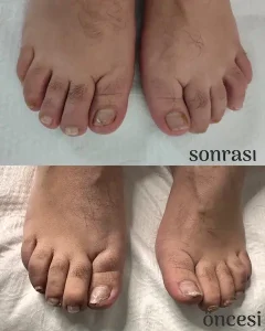 Çankaya Pedikür Ayak ve Tırnak Bakım Merkezi