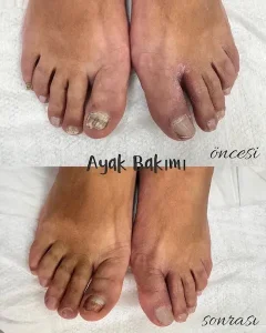 Çankaya Pedikür Ayak ve Tırnak Bakım Merkezi