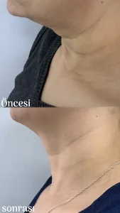 Ankara-Çankaya gıdı sıkılaştırma güzellik merkezi.