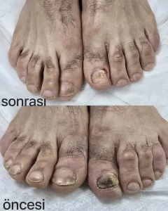 Çankaya Pedikür Ayak ve Tırnak Bakım Merkezi