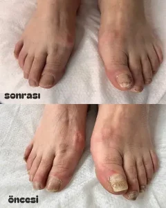 Çankaya Pedikür Ayak ve Tırnak Bakım Merkezi