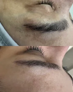 Ankara-Yıldız Anti-aging cilt sıkılaştırma merkezi.